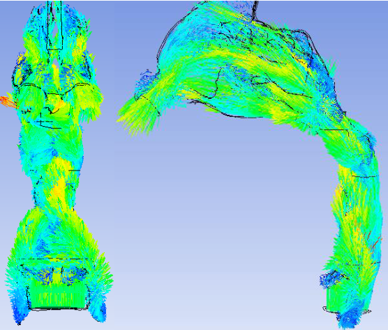 术后呼气过程速度矢量分布