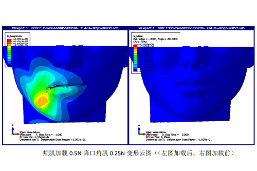 评估降口角肌加载力（0.25N）对术后口角形态的维持作用。