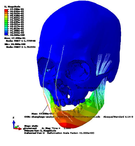 工况二整体变形云图