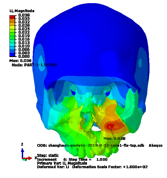 工况一整体变形云图